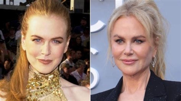 Nicole Kidman Facelift: A Comprehensive Look at Her Transformation and Impact on the Beauty Industry